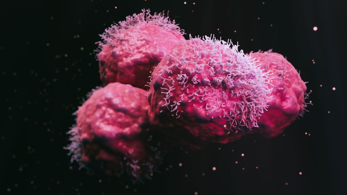 Pancreatic Cancer